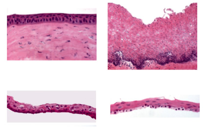 角膜上皮（左上）と比べると口の中の粘膜上皮（右上）は表面に凹凸があり、厚みもある。しかし、ある条件で培養すると、角膜上皮（左下）と似たシートを口腔粘膜の細胞から作ることができる（右下）。