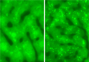 GFP-LC3マウスの肝臓凍結切片の蛍光顕微鏡像