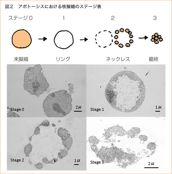 図2　アポトーシスにおける核凝縮のステージ表