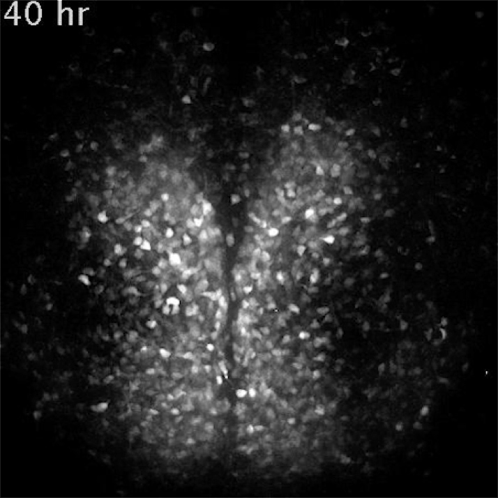 うなじを左右に開くだけで156年眠った遺伝子が覚醒 河野整体遺伝子覚醒法 DVD 遺伝子変異による疾患を正確に予測、DeepMindの新たな機械学習モデルが