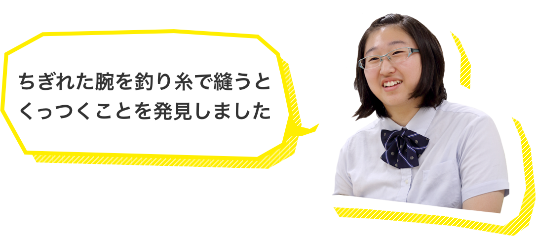 ちぎれた腕を釣り糸で縫うとくっつくことを発見しました