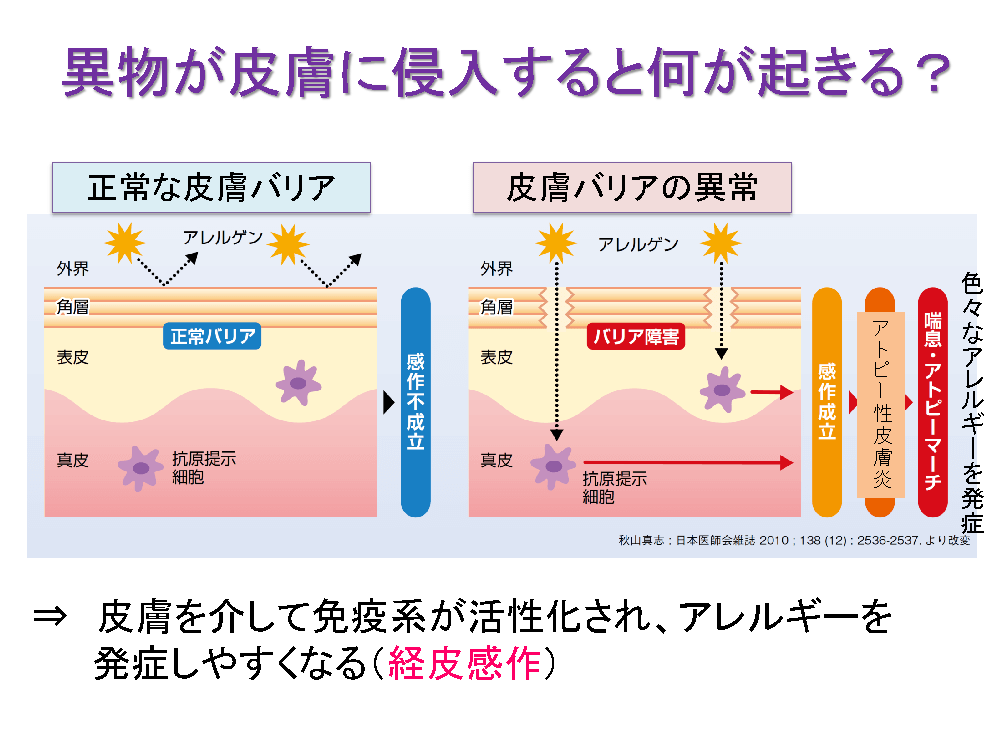 異物が皮膚に侵入すると何が起きる？