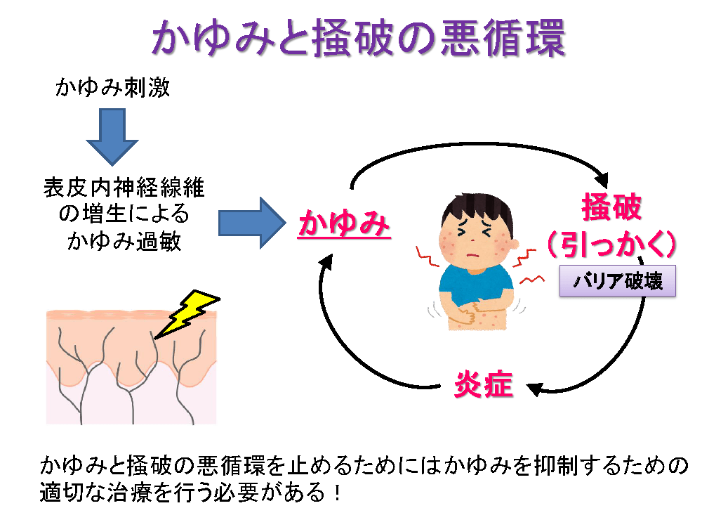 かゆみと掻破の悪循環