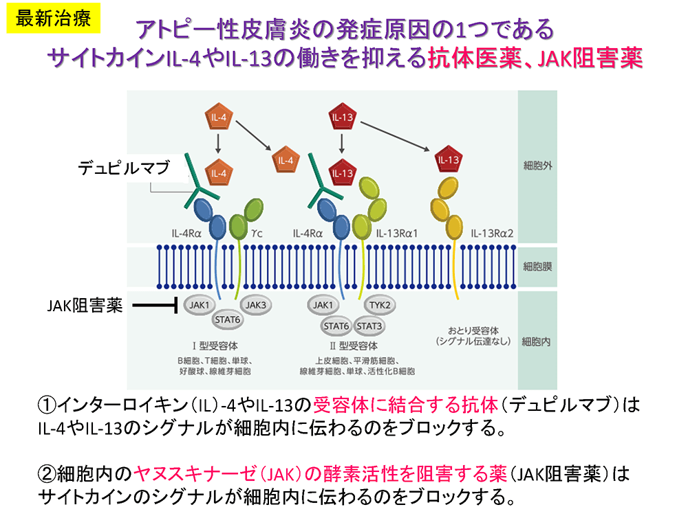 アトピー性皮膚炎の発症原因の１つであるサイトカインIL-4やIL-13の働きを抑える抗体医薬、JAK阻害薬