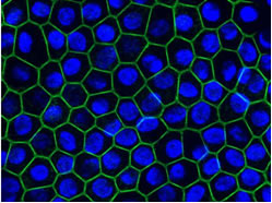 サルのES細胞からつくられた六角形の網膜色素上皮細胞（「Nature Biotechnology」2008年掲載の論文（26:215-224ページ）より）