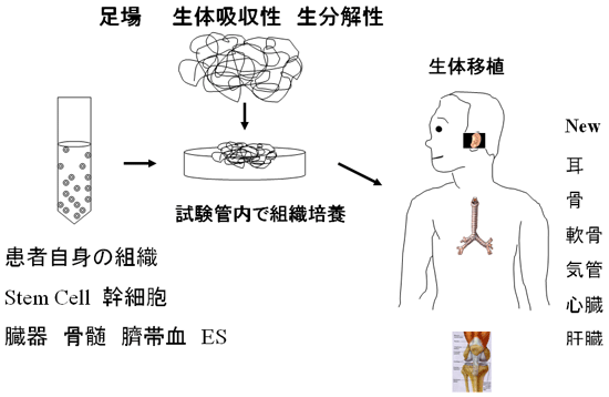 患者さん自身の細胞を培養して、その細胞を足場となる骨組みに付着させ、人体に埋め込んで、目的の臓器をつくりだす。