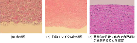 ブタ大動脈弁のヘマトキシリン・エオジン染色像:岩崎先生たちの処理で黒い粒の細胞核を完全に除去(b)。その無細胞組織を動物に移植すると、移植された動物自身の細胞が入ってくることがわかった(c)。