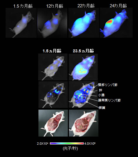 老化イメージング