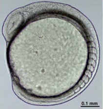 ゼブラフィッシュの胚：背側に節のように見える構造が椎骨の原基