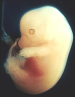 マウス受精後12日目の胚（胎仔）。この頃には既に大まかな体ができあがっている
