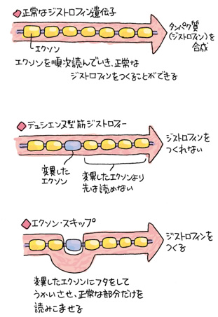 エクソン・スキップ