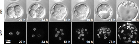 メチローマウスを用いたライブセルイメージング画像。2細胞期受精卵から胚盤胞期までの約4日間、核内のメチル化DNAの変化を安定して観察できるようになった