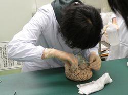 実際の脳を使って脳標本をつくる作業が始まった