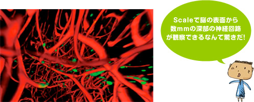 マウスの海馬における神経幹細胞の核（緑色）と血管（赤色）