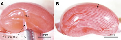（Ａ）マイクロカテーテルを使ってマウス腎臓皮膜下に膵島細胞ファイバーを移植している様子（Ｂ）20ｃｍの膵島細胞ファイバーが移植された様子。図中の矢印は、移植された膵島細胞ファイバーを示す