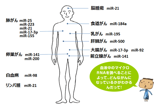 血液中のマイクロRNAを調べることによって、どんながんになっているかがわかるんだって！