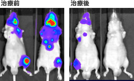 血液中のマイクロRNAを調べることによって、どんながんになっているかがわかるんだって！