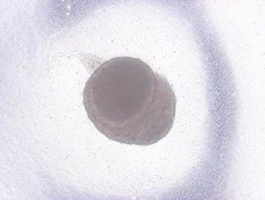 辻先生たちが開発した器官原基法でつくり出した歯のタネ(再生歯胚)